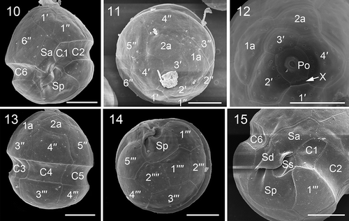Figs 10–15. Scanning electron micrographs of vegetative cells of Johsia chumphonensis strain TIO606. Fig. 10. Ventral view showing the first apical plate (1′), anterior sulcal plate (Sa), posterior sulcal plate (Sp), and three cingular plates (C1, C2, C6). Fig. 11. Apical view showing four apical plates, two anterior intercalary plates (1a, 2a) and six precingular plates (1′′–6′′). Fig. 12. Internal apical view showing pore plate and canal plate (X). Fig. 13. Dorsal view showing two anterior intercalary plates, three precingular plates, three cingular plates and two postcingular plates (3′′′, 4′′′). Fig. 14. Antapical view showing five postcingular plates and two antapical plates (1′′′′, 2′′′′) of similar size. Fig. 15. Sulcal area showing Sa plate, right sulcal plate (Sd), left sulcal plate (Ss), and Sp plate. Scale bars = 5 μm