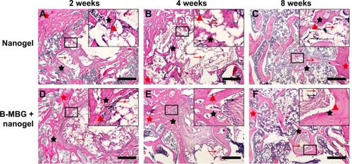 Figure 3 H&E staining of PIB nanogels alone (A–C) and B-MBG/nanogels (D–F) at 2, 4, and 8 weeks post-implantation (bar =100 μm).Notes: Red arrow, residual material; black arrow, fibroblasts; red triangle, osteoblasts; red star, old bone; black star, new bone.Abbreviations: PIB, p(N-isopropylacrylamide-co-butyl methylacrylate); B-MBG, boron-containing mesoporous bioactive glass; H&E, hematoxylin and eosin.