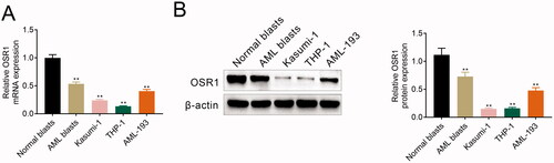 Figure 1. Reduced OSR1 in acute myeloid leukaemia. (A) mRNA expression of OSR1 was reduced in the blasts isolated from the patients and acute myeloid leukaemia cells (Kasumi-1, THP-1 and AML-193) compared to the healthy volunteers. (B) Protein expression of OSR1 was reduced in the blasts isolated from the patients and acute myeloid leukaemia cells (Kasumi-1, THP-1 and AML-193) compared to the healthy volunteers. ** vs. normal blasts, p < .01.