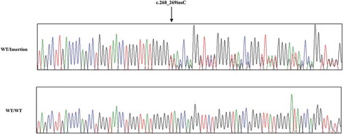 Figure 4. Electropherogram of c.268_269insC polymorphism in chicken PRNP gene. Four colors indicate individual bases of DNA sequence using ABI 3730 automatic sequencer (blue: cytosine, red: thymine, black: guanine, green: adenine). Sanger sequencing was performed by reverse gene-specific primer, as described in the materials and method section. Arrows indicate c.268_269insC polymorphism found in this study. Upper portion: heterozygote of c.268_269insC polymorphism. Lower portion: wild-type of the chicken PRNP gene sequence. WT: wild-type of the chicken PRNP gene sequence. Insertion: c.268_269insC polymorphisms of the chicken PRNP gene sequence.