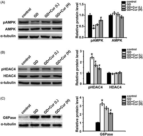 Figure 3. Effects of curcumin (Cur) on AMPK signaling pathway in gestational diabetes (GD) mice. The expression levels of total AMPK, p-AMPK (A), pHDAC4, total HDAC4 (B) and G6Pase (C) were detected by Western Blot in the livers of pregnant mice on gestation day 20. (p)AMPK: (phosphor-) AMP-activated protein kinase; (p)HDAC4: (phosphor-) histone deacetylases; G6Pase: glucose-6-phosphatase. *p < 0.05, compared with control; #p < 0.05, compared with GD.