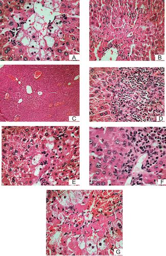 Figure 1.  Representative microphotographs of H&E (×10)-stained histological sections of liver (1A) CCl4 control; (1B) mice treated with fraction A0 (distilled water fraction of Justicia schimperiana), 50 mg/ kg, p.o. and CCl4 (25 µL/kg, i.p.); (1C) vehicle control; (1D) mice treated with A0, 100 mg/kg and CCl4 (25 µL/kg, i.p.); (1E) mice treated with silymarin 50 mg/kg, p.o. and CCl4 (25 µL/kg, i.p.); (1F) mice treated with A1 (25% methanol fraction of Justicia schimperiana), 50 mg/kg and CCl4 (25 µL/kg, i.p.); (1G) mice treated with fraction A4 (pure methanol fraction of Justicia schimperiana) 50 mg/kg, p.o. and CCl4 (25 µL/kg, i.p.).