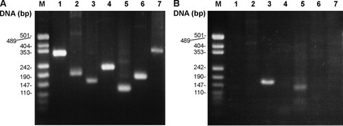 Figure 2 Agarose gel electrophoresis of the PCR products from vitreous.