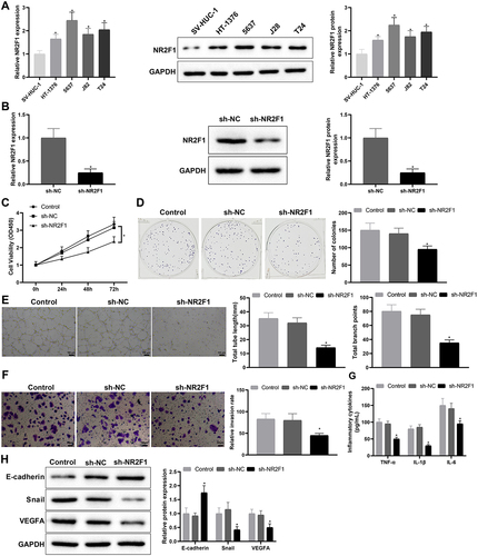 Figure 2. Low expression of NR2F1 suppressed inflammation and vascular mimicry in BC cells.