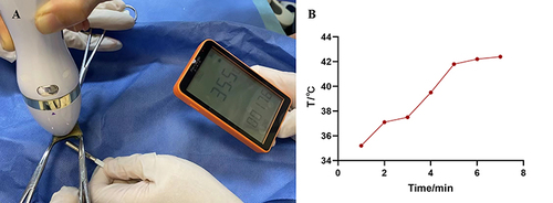 Figure 3 (A) Skin tissue treated with MF-HIFU and the temperature measuring device. (B) Temperature in the skin tissue beneath the epidermis.