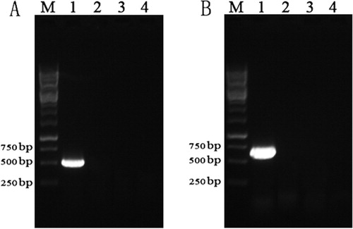 Figure 3. PCR-based detection of ALV-J genes in tissues from inoculated geese. (A) PCR-based screening for gp85 in liver tissues. (B) PCR-based screening for p27 in liver tissues. Lane M, 1 kb DNA marker; lane 1, positive control; lane 2, negative control; lane 3, tissues from geese infected with 104 TCID50 of ALV-J; lane 4, tissues from geese infected with 105 TCID50 of ALV-J