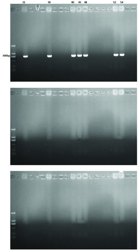 Figure 2 Detection of VIM genes of carbapenem-resistant Acinetobacter baumannii clinical isolates by PCR.