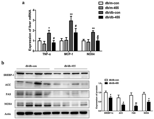 Figure 3. Overexpression of miR-455 ameliorated the liver inflammation and oxidative stress. (a): The mRNA expression of TNF-α, MCP-1 and NOX4 of liver in four groups. (b) The protein levels of SREBP-1c, ACC, FAS and NOX4 in liver of db/db-con group and db/db-455 group, the quantitative analysis results of protein levels. n = 6–8 per group. *P < 0.05 and **P < 0.01 vs db/m-con group; #P < 0.05 and ##P < 0.01 vs db/db-con group