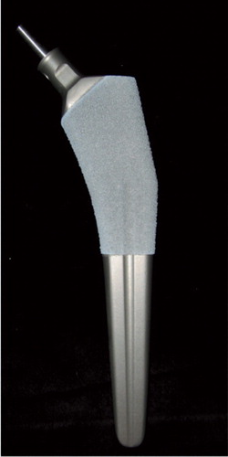 Figure 1. Taperloc stem coated with Bonemaster.