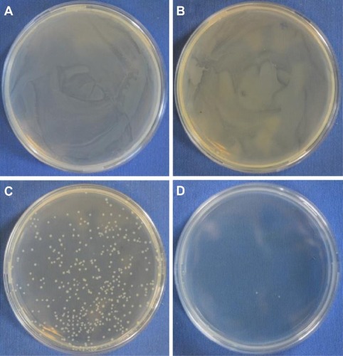 Figure 7 Antibacterial potential of AgNPs by colony counting method.Notes: Escherichia coli without treatment (just water) (A), E. coli treated with plant extract (B), E. coli treated with AgNO3 (C), and E. coli treated with AgNPs (D).Abbreviation: AgNPs, silver nanoparticles.