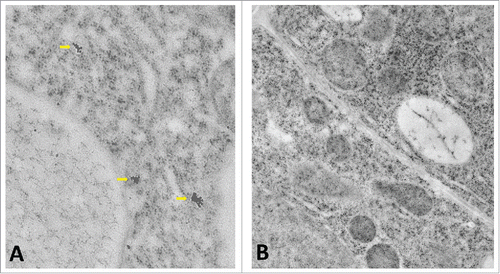 Figure 3. (A) Three IAA clusters in a transition zone epidermis cell labeled with the polyclonal IAA antibody. (B) Negative control of similar cell using only the secondary antibody results in no gold particles.