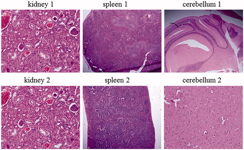 Figure 6. Different morphological patterns of kidney, spleen and cerebellum. (1) References and (2) display after injection of ZnO nanofluid.