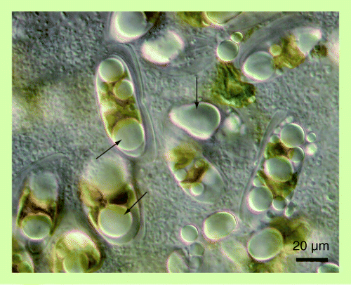 Figure 1.  Diatom cells including lipid bodies (shown by arrows) in their cytoplasm.