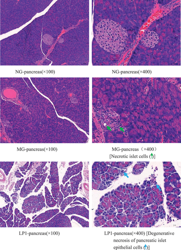 Figure 8. H & E pathological observation of mouse pancreas(a-d). Normal group (NG); STZ treatment group (MG); STZ + L. plantarum SCS5 suspension group (LP1); STZ + L. plantarum SCS5 intracellular material group (LP2); STZ + L. plantarum SCS5 heat-killed intracellular material group (LP3).