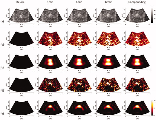 Figure 6. Typical (a) B-mode, (b) |CBE|, (c) |CBE¯|, (d) CBE|η>0, and (e) CBE¯|η>0 images obtained at various time points and under using temporal compounding (ATL = 1.5 cm).