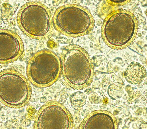 Figure 7 Toxocara vitulorum eggs.