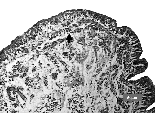 Figure 4.  Oviduct of an affected goose with oedema in the uterus and infiltration of the lamina propria with heterophils (see arrow). Bar = 50 µm.