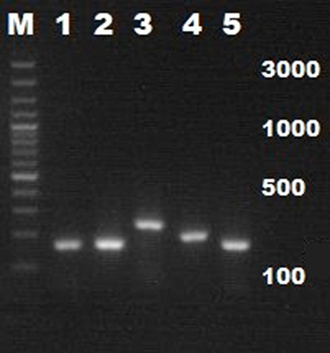 Figure 3 PCR results of DNA topoisomerase 4 subunit A from M.hyo HNSH strain. 1= parC. 2= parE. 3=16sRNA gene. 4= gyrA. 5= gyrB.