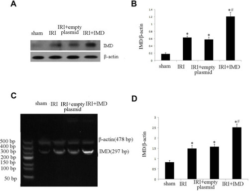 Figure 1 The transfection efficiency of IMD by ultrasound-mediated gene delivery into the kidneys. (A) The IMD protein expression measured by Western blot in rat kidneys. (B) Quantitative analysis of IMD by Western blots in rats. (C) The IMD mRNA expression measured by RT-PCR in rat kidneys. (D) The densitometric quantifications of band intensities from RT-PCR for IMD/β-actin in rat kidneys. Data in bar graphs are the means ± SD, n = 20. *P < 0.05 vs sham group; #P < 0.05 vs IRI group, respectively.