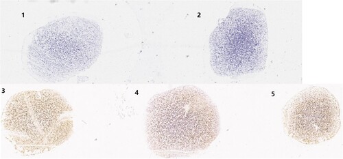 Figure 5. ScanScope images of the three HBoV2 mRNA transcripts at 72 h post-transfection. 1: HEK293 cells transfected with pBlueScript; 2: Untreated HEK293 cell control; 3: HEK293 cells transfected with pBlueScript-HBoV2 5043–5042; 4: HEK293 cells transfected with pBlueScript-HBoV2 5075–5074; 5: HEK293 cells transfected with pBlueScript-HBoV2 5220–5219.