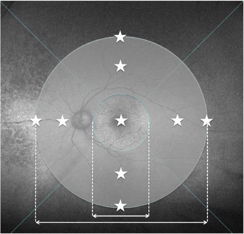 Figure 1 Nine measurement points of choroidal thickness and the area between the 3-papilla diameter and 9-papilla diameter circles (midperipheral area) in which abnormal autofluorescence abnormalities were investigated.