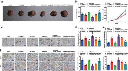 Figure 6. NORAD silencing or miR-323a-3p elevation represses the tumor growth in BC nude mice. A, representative images of xenografts resected from nude mice injected with transfected MDA-MB-453 cells; B, weight and volume of xenografts resected from nude mice injected with transfected MDA-MB-453 cells; C, representative images of TUNEL staining of xenografts resected from nude mice injected with transfected MDA-MB-453 cells; D, ratio of TUNLE positive cells in xenografts resected from nude mice injected with transfected MDA-MB-453 cells; E, miR-323a-3p in xenografts resected from nude mice injected with transfected MDA-MB-453 cells; F, PUM1 and p-PERK expression in xenografts resected from nude mice injected with transfected MDA-MB-453 cells was detected using immunohistochemical staining (200 ×); n = 6; the measurement data conforming to the normal distribution were expressed as mean ± standard deviation and one-way ANOVA was used for comparisons among multiple groups, followed by Tukey’s post hoc test; * P < 0.05 vs the si-NC group; # P < 0.05 vs the NC-mimic group; $ P < 0.05 vs the si-NORAD + NC-inhibitor group