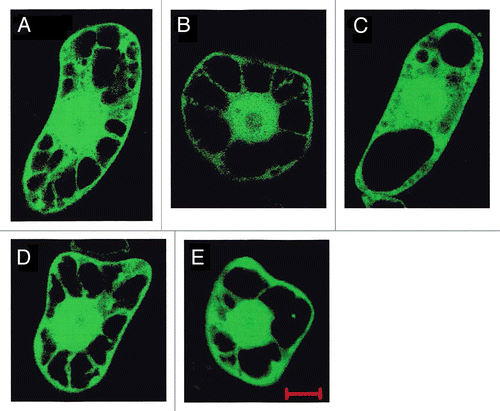 Figure 2. Subcellular localization of AtNAS-sGFP fusion proteins in tobacco BY-2 cells. Shown are tobacco BY-2 cells, which transiently express sGFP (A), AtNAS1-sGFP (B), AtNAS2-sGFP (C), AtNAS3-sGFP (D) and AtNAS4-sGFP (E)fusion proteins under the control of the CaMV 35S promoter, observed by confocal fluorescence microscopy. Transient expression in tobacco BY-2 cells was performed as described previously.Citation41 Scale bar represents 10 μm.
