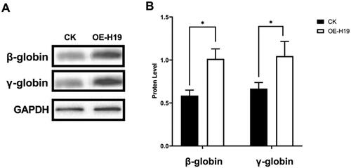 Figure 6. Detection of β-globin and γ-globin expression in CD34+ cells on culture day 11 by Western blotting; analysis of relative expression in the OE-H19 and CK groups (*P < 0.05).