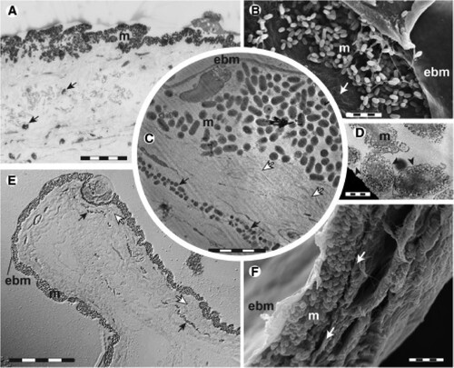 Figure 1. Skin ultrastructure and melanosome geometry of deep-sea ultra-black fishes, Oneirodes sp. (A) and Idiacanthus antrostomas (B–F). Image reproduced without modification from [Citation1].