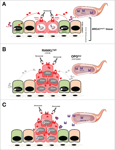 Figure 3. Dysregulation of the OPG/RANKL/RANK signaling axis and BRCA1 deficiency-driven breast oncogenesis: (A)new target for anti-cancer metformin. Molecular dialog between progesterone (Pg)-responsive cells and hormone receptor (HR)-negative luminal progenitors seems to drive the hyperproliferation of breast cancer-initiating cell populations within the breast epithelia of BRCA1 mutation carriers.Citation11,12 In a hormone-dependent stage (e.g., pre-menopausal women), RANKL secretion might become stimulated upon binding of Pg to its receptor (PR) in mature ductal cells (i.e., so-called “sensor” cells); secreted RANKL then binds and activates RANK on RANK+ luminal progenitors (i.e., so-called “responder” cells). Generally, OPG negatively regulates RANKL/RANK signaling by binding to RANKL as an endogenous decoy receptor, thereby inhibiting signal transduction. However, the mitogenic cross-talk between RANKL-producing sensor cells and RANKL-addicted responder cells might be less restricted in high-risk subgroups of BRCA1 mutation carriers with significant lower plasma levels of OPG. The net magnitude of the OPG/RANKL/RANK signaling axis in driving BRCA1-related breast oncogenesis may be largely determined by local increases of RANKL along with decreases in systemic OPG. Our recent findings in HR-negative, basal-like MCF10A breast epithelial cells with a pathogenic185delAG mutation in one BRCA1 alleleCitation13 further suggest that, in the absence of hormone influence, breast cancer-initiating cells may remain responsive to RANKL stimulation because compromised DNA repair and consequent genomic instability provoked by BRCA1 haploinsufficiency might suffice to establish hyperplasic states via an auto-regulatory feedback loop triggered by cell-autonomous hyperactivation of RANKL gene expression. Such a hormone-independent scenario might become reinforced by low circulating levels of OPG not only in post-menopausal BRCA1 carriers but also in other post-menopausal groups at high risk for breast cancer and in women with circulating tumor cells. The ability of metformin (MET) to restore dysregulated OPG/RANKL/RANK signaling may represent an important clinical opportunity to prevent breast cancer and maintain bone health (e.g., following salpingo-oophorectomy) in BRCA mutation carriers and to treat RANKL-driven metastasis-initiating lesions in combination with denosumab.