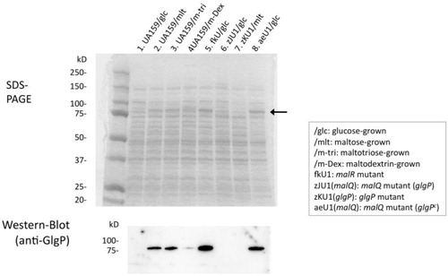 Fig. 2 Expression of the GlgP protein in S. mutans. SDSPAGE and Western blot analysis were performed as described in the text. An arrow indicates GlgP protein bands appeared in the SDSPAGE. Cells were grown in BTR-sugar broth.