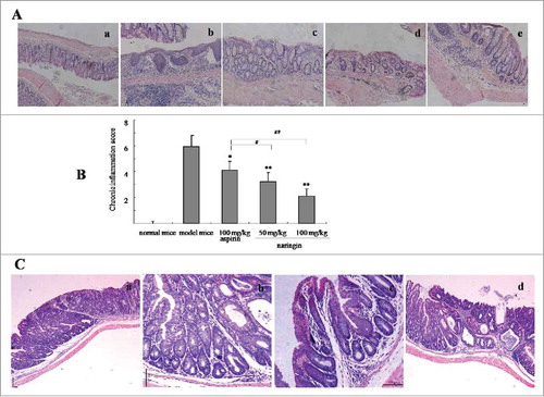 Figure 2. H&E-stained colorectal sections from model mice and drug-treated mice (50× ). (A) Naringin prevented colorectal inflammation. A-a. normal mice; A-b. model mice; A-c. Naringin with 50 mg/kg treated mice; A-d. Naringin with 100 mg/kg treated mice; A-e. Aspirin-treated mice. (B) Naringin reduced colitis evaluated by inflammation score. *P < 0.05, **P < 0.01 between model mice and drug-treated mice. # P < 0.05, ## P < 0.01 between naringin and aspirin. (C) Naringin prevented inflammation-driven colorectal adenomas. C-a. model mice; C-b. Naringin 50 mg/kg; C-c. Naringin 100 mg/kg; B-d. Aspirin 100 mg/kg.