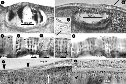 Figure 6. Phragmope discrepans gen. & comb.nov. Tetrasporangial structures; a, multiporate conceptacle with tetrasporangia (arrows); b-f, sections of canals of multiporate roofs. Canals are straight and lined by 4–6 non-differentiated cells (arrowheads), inclusive epithallial cells (black arrowheads). Canal closure initiates with cells projecting from the opposite basal cells (white arrows in Figure d), and the projecting cells subsequently coalesce to form a barrier (white arrows in Figures e-f). A new compact ‘roof’ (black arrow in Figure e) is formed; g, development of a compact ‘roof’ (arrow) above an old multiporate conceptacle; h, margin of a compact ‘roof’ (arrowheads), and a putative initial of a similar formation below (arrow); i, compact ‘roof’ composed of 1–2 perithallial (white arowhead) and a layer of epithallial cells (arrow) above the old roof (black arrowhead). Materials: a-c, e-f, D16-YMC 89/300; d, g-i, D10-YMC 91/80.