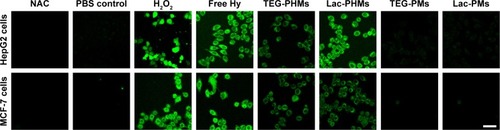 Figure 4 Fluorescence images of DCF in HepG2 and MCF-7 cells incubated with free Hy, TEG-PHMs, Lac-PHMs, TEG-PMs, and Lac-PMs after receiving 595–600 nm light exposure for 30 minutes (scale bar: 50 nm).Notes: The concentration of free Hy and Hy in Lac-PHMs and TEG-PHMs was 1.0 μM. The concentration of Lac-PMs and TEG-PMs was 15 μg mL−1. The cells were, respectively, incubated with free Hy or the NPs for 4 hours at 37°C before irradiation. Cells without any treatment were used as PBS control; the H2O2- and NAC-treated cells were used as the positive and negative controls, respectively.Abbreviations: Hy, hypericin; NAC, N-acetylcysteine; PMs, polydopamine–MNP composite nanoparticles; PHMs, hypericin-entrapped polydopamine–MNP composite nanoparticles; TEG-PMs, triethylene glycol–modified PMs; Lac-PMs, lactose-modified PMs; TEG-PHMs, triethylene glycol–modified PHMs; Lac-PHMs, lactose-modified PHMs; DCFDA, 2′,7′-dichlorofluorescin diacetate; DCF, 2′,7′-dichlorofluorescein.