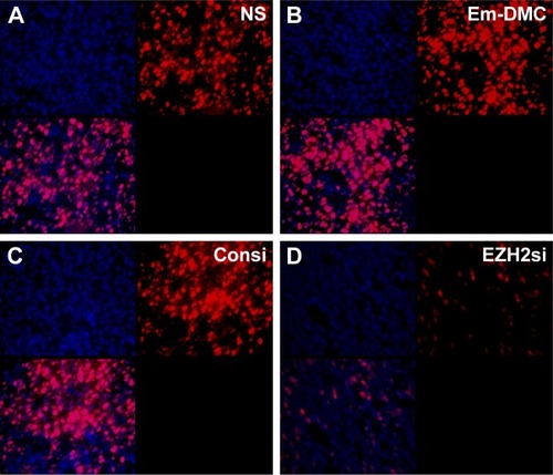 Figure 9 EZH2 expression detection in vivo.Notes: (A) Intracerebral glioma was seen by using fluorescence markers. Tumor was inhibited more effectively by DMC-EZH2si complex, compared with other groups. (B) Life survival time assessment. DMC-EZH2si complex extended life spans of mice. The EZH2 expression of NS (A), DMC (B) and DMC-Consi (C) were higher than DMC-EZH2si (D). Results indicated that the EZH2 was successfully knocked down by the DMC-EZH2si complex.