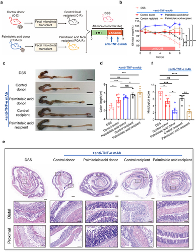 Figure 6. Palmitoleic acid (POA)-educated microbiota improves the efficacy of anti-TNF-α therapy against colitis.