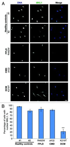Figure 1. MKL1 translocation in primary human skin fibroblasts from diverse laminopathy patients and healthy controls. (A) Representative images of MKL1 staining in healthy control fibroblasts and human laminopathy patient fibroblasts stimulated for 15 min with 15% fetal bovine serum and subsequently fixed with 4% paraformaldehyde and immunofluorescently labeled for MKL1. DNA is shown in blue and MKL1 is shown in green. Scale bar, 20 µm. (B) Quantitative analysis of cells with MKL1 nuclear localization after serum stimulation (n = 3, *** P < 0.005).