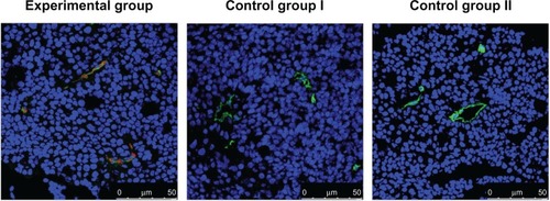 Figure 2 Immunofluorescence images of laser scanning confocal microscopy of BcaCD885 tumor frozen sections stained with QD800-RGD.