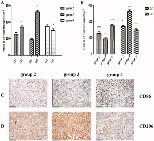 Figure 5. The administration of corosolic acid increases M1 and decreases M2 macrophages in tumours. (A) The proportion of M1 and M2 macrophages per square millimetre in each group with implanted tumours. (B) The number of M1 and M2 macrophages per square millimetre in each group with implanted tumours. (C) The immunohistochemical (HIC) staining for CD86+ macrophages in the tumour tissue in each group with implanted tumours. (D) The HIC staining for CD206+ macrophages in tumour tissue in each group with implanted tumours. Scale bars, 50 µm. *P < .01 M1 vs. M2; group 2 vs. group 3; **P < .01 for group 3 vs. group 4; ***P < .01 for group 2 vs. group 4; ****P < .05 for group 2 vs. group 3. The HIC staining for cells with the nuclear deposition of violet pigment was positive (black arrow), and the nuclear deposition of blue pigment was negative (red arrow) (original magnification x200). Values are given as the means ± the standard deviation. Group 1 is the mock group; group 2 is the implantation without associating liver partition and portal vein ligation (ALPPS) group; group 3 is the implantation/ALPPS group; group 4 is the implantation/ALPPS/CA group.