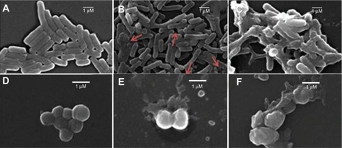 Figure 6 Micrographs of Escherichia coli (A–C) or Staphylococcus aureus (D–F) cells untreated (A, D) or treated with DODAB BF/Gr (B, E) or DODAB LV/Gr dispersions (C, F), obtained by scanning electron microscopy. Cells appear enlarged by 10,000× (E. coli) or 20,000× (S. aureus). Against E. coli cells, in (B), DODAB =0.005 mM (DODAB BF/Gr) and, in (C), DODAB =0.01 mM (DODAB LV/Gr). Against S. aureus, in (E), DODAB =0.01 mM (DODAB BF/Gr) and, in (F), DODAB =0.05 mM (DODAB LV/Gr).Abbreviations: DODAB, dioctadecyldimethylammonium bromide; LV, closed bilayers; BF, bilayer disks; Gr, Gramicidin.