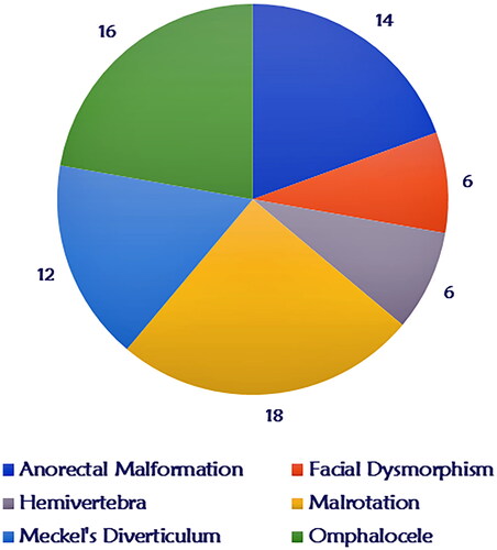 Figure 3. Commonest reported associated anomalies. This shows that most common associated birth defect are: malrotation, anorectal malformations, omphalocele and Meckel’s diverticulum patients.