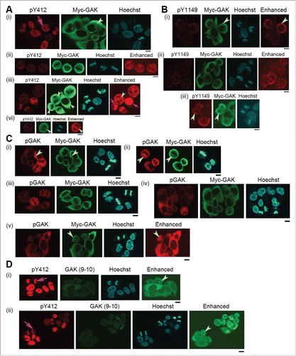Figure 7. Subcellular localizations of GAK, GAK-pY412, and GAK-pY1149 in HeLa S3 cells expressing GAK-Y1149F proteins in the presence of Dox. Anti-GAK-pY412 polyclonal antibody, anti-GAK-pY1149 polyclonal antibody, anti-GAK polyclonal antibody (pGAK), anti-GAK monoclonal antibody (9–10), and anti-Myc (for Myc-GAK) monoclonal antibody were used for immunostaining. Contrast-enhanced images are also shown in the rightmost panels. Pink arrows indicate pY412 images in the nucleus. Pale green arrowheads emphasize the cytoplasmic signals of pY412, pY1149, Myc-GAK, pGAK, and GAK (9–10). Hoechst, Hoechst33258 used to detect DNA in the nucleus. Bar, 10 µm.