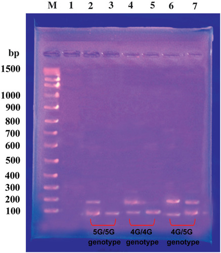 Figure 1 Gel electrophoresis of PCR products. Lane 1; 100-bp marker; lane 2, 3 represent the 5G/5G genotype; lane 4, 5 represent the 4G/4G genotype; and lane 6, 7 represent the 4G/5G genotype.