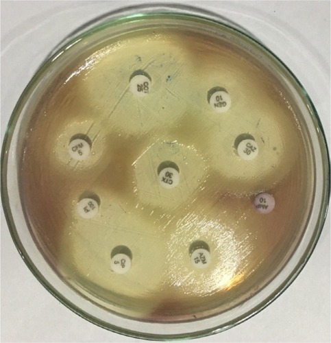 Figure 4 Antimicrobial susceptibility test of Chromobacterium violaceum.