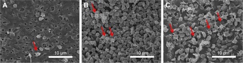 Figure 4 (A) Dose 1 ticagrelor. (B) Dose 2 ticagrelor. (C) Non-drug eluting nanofiber.Notes: Red arrows indicate activated platelets (scale bars = 10 µm). Magnification 3,000×.