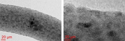 Figure 4 TEM image showing AgNPs on a nanofiber.Abbreviations: TEM, transmission electron microscopy; AgNPs, silver nanoparticles.