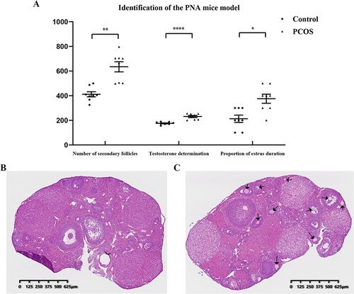 Figure 4 Serological and morphological identification of prenatal androgenized (PNA) mice. (A) The proportion of estrus duration, serum testosterone concentration, and number of secondary follicles in PNA mice and control groups (*P<0.05, **P<0.01, ****P<0.0001; multiply the proportion of estrus duration data by 100 to ensure the vertical height); (B) Control group mouse ovary HE staining section; (C) PNA mouse ovary HE staining section; the black arrows indicate the primordial follicles.
