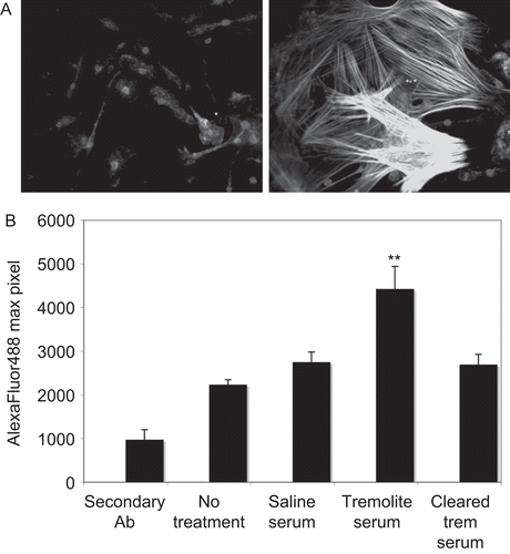 Figure 2.  Expression of smooth muscle α-actin (SMA) is induced by treatment with sera from asbestos-exposed mice. (A) Mouse primary skin fibroblasts treated with sera from (left panel) saline- or (right panel) tremolite-exposed mice for 24 h were then fixed, permeabilized, and stained with anti-SMA. The secondary antibody was Alexa 488-conjugated and fluorescence was visualized at 400×. (B) The experiment was repeated using C57Bl/6 primary lung fibroblast cells, and fluorescence from the SMA expression was quantified by LSC as described in Materials and methods section. N = 3, **P < 0.01 comparing SMA expression induced by tremolite mouse serum to expression by untreated cells, using one-way ANOVA with Bonferroni’s Multiple Comparison Test.