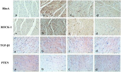 Figure 4. Immunohistochemistry results. (a) Normal control group of rats. (b) RhoA, ROCK-1and TGF-β1 of rats in group B were significantly higher than those in the other three groups, while PTEN protein was significantly lower than those in the other three groups. (c) Compared with group B, the expression of RhoA, ROCK-1and TGF-β1 in group C decreased, and PTEN protein increased. (d) Compared with group C, the expression of RhoA, ROCK-1and TGF-β1in group D further decreased, and PTEN protein increased.