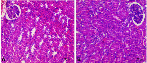 Figure 8 The pathological changes of the kidney tissue of MRSA-infected mice. (A): control group, (B): model group.
